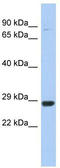 Chromosome 21 Open Reading Frame 91 antibody, TA338936, Origene, Western Blot image 