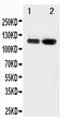 Selectin E antibody, PA1704, Boster Biological Technology, Western Blot image 