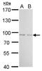 Forkhead Box O1 antibody, GTX110724, GeneTex, Western Blot image 