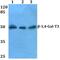 Beta-1,4-Galactosyltransferase 3 antibody, PA5-36434, Invitrogen Antibodies, Western Blot image 