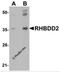 Rhomboid domain-containing protein 2 antibody, 5527, ProSci, Western Blot image 