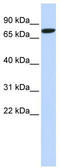 Delta Like Canonical Notch Ligand 1 antibody, TA339016, Origene, Western Blot image 