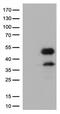 Fc Fragment Of IgG Receptor IIa antibody, GTX84518, GeneTex, Western Blot image 