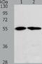 Proteasome 26S Subunit, Non-ATPase 5 antibody, TA324261, Origene, Western Blot image 