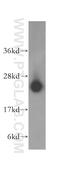 Lysophospholipase 1 antibody, 16055-1-AP, Proteintech Group, Western Blot image 