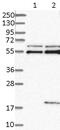 Cancer/Testis Antigen 83 antibody, ab121219, Abcam, Western Blot image 