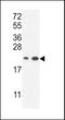 Abhydrolase Domain Containing 14B antibody, MBS9210667, MyBioSource, Western Blot image 