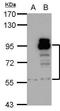 Phosphodiesterase 4D antibody, TA308932, Origene, Western Blot image 