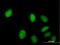 Zinc Finger C2HC-Type Containing 1A antibody, H00051101-B01P, Novus Biologicals, Immunocytochemistry image 