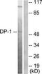 TFDP1 antibody, TA314614, Origene, Western Blot image 