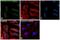 CREB-regulated transcription coactivator 3 antibody, MA5-14919, Invitrogen Antibodies, Immunofluorescence image 