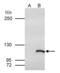 SWI/SNF Related, Matrix Associated, Actin Dependent Regulator Of Chromatin, Subfamily A Like 1 antibody, PA5-28980, Invitrogen Antibodies, Immunoprecipitation image 