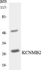Potassium Calcium-Activated Channel Subfamily M Regulatory Beta Subunit 2 antibody, LS-B14676, Lifespan Biosciences, Western Blot image 