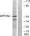 G Protein-Coupled Receptor 152 antibody, TA316432, Origene, Western Blot image 