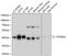 Stomatin-like protein 2 antibody, GTX64801, GeneTex, Western Blot image 