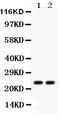 HNL antibody, PB9610, Boster Biological Technology, Western Blot image 