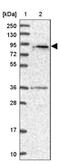 Spermatogenesis Associated 5 Like 1 antibody, NBP1-92430, Novus Biologicals, Western Blot image 