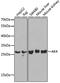 Adenylate kinase isoenzyme 4, mitochondrial antibody, A2050, ABclonal Technology, Western Blot image 