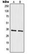 Mitochondrial Ribosomal Protein S35 antibody, LS-C353512, Lifespan Biosciences, Western Blot image 