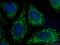 Cellular Communication Network Factor 1 antibody, 26689-1-AP, Proteintech Group, Immunofluorescence image 