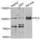 Plasminogen antibody, LS-C335337, Lifespan Biosciences, Western Blot image 