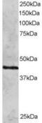 DNA repair protein RAD51 homolog 3 antibody, PA5-18106, Invitrogen Antibodies, Western Blot image 