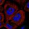 Chromosome 11 Open Reading Frame 80 antibody, HPA038933, Atlas Antibodies, Immunofluorescence image 