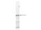 3-Phosphoinositide Dependent Protein Kinase 1 antibody, TA319161, Origene, Western Blot image 