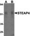 Metalloreductase STEAP4 antibody, NB100-80831, Novus Biologicals, Western Blot image 