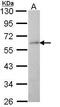 Coronin 1A antibody, PA5-29875, Invitrogen Antibodies, Western Blot image 