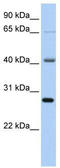 RNA Binding Motif Protein 34 antibody, TA343823, Origene, Western Blot image 