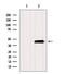 Solute Carrier Family 10 Member 2 antibody, GTX03115, GeneTex, Western Blot image 