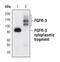 Fibroblast Growth Factor Receptor 3 antibody, MA5-14843, Invitrogen Antibodies, Western Blot image 