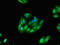 Tripartite Motif Containing 54 antibody, CSB-PA861180LA01HU, Cusabio, Immunofluorescence image 