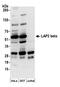 Lamina-associated polypeptide 2, isoform beta antibody, A304-840A, Bethyl Labs, Western Blot image 