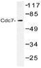 Cell division cycle 7-related protein kinase antibody, AP20508PU-N, Origene, Western Blot image 