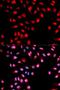 c-met antibody, LS-C335770, Lifespan Biosciences, Immunofluorescence image 