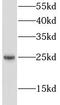 Lin-7 Homolog C, Crumbs Cell Polarity Complex Component antibody, FNab04790, FineTest, Western Blot image 