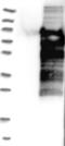Zinc Finger And SCAN Domain Containing 18 antibody, NBP1-87389, Novus Biologicals, Western Blot image 