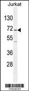 Glutamate Decarboxylase 2 antibody, 55-644, ProSci, Western Blot image 