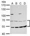 Malonyl-CoA decarboxylase, mitochondrial antibody, TA307998, Origene, Western Blot image 