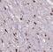 Lysine Acetyltransferase 2B antibody, FNab06188, FineTest, Immunohistochemistry frozen image 