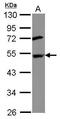 DEP domain-containing mTOR-interacting protein antibody, GTX116540, GeneTex, Western Blot image 