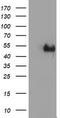 LIM Homeobox 1 antibody, TA504528S, Origene, Western Blot image 