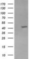 Potassium Voltage-Gated Channel Subfamily A Member Regulatory Beta Subunit 1 antibody, MA5-25789, Invitrogen Antibodies, Western Blot image 
