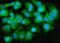 Microsomal Triglyceride Transfer Protein antibody, A01715-1, Boster Biological Technology, Immunofluorescence image 