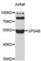 Vacuolar Protein Sorting 4 Homolog B antibody, STJ26099, St John