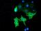 Myotubularin Related Protein 14 antibody, MA5-25255, Invitrogen Antibodies, Immunocytochemistry image 