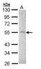 Matrix Metallopeptidase 16 antibody, GTX109378, GeneTex, Western Blot image 