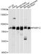 Poly(ADP-Ribose) Polymerase Family Member 12 antibody, A14317, ABclonal Technology, Western Blot image 